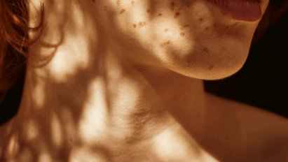 Vitamin D und seine Bedeutung für die (Haut)gesundheit