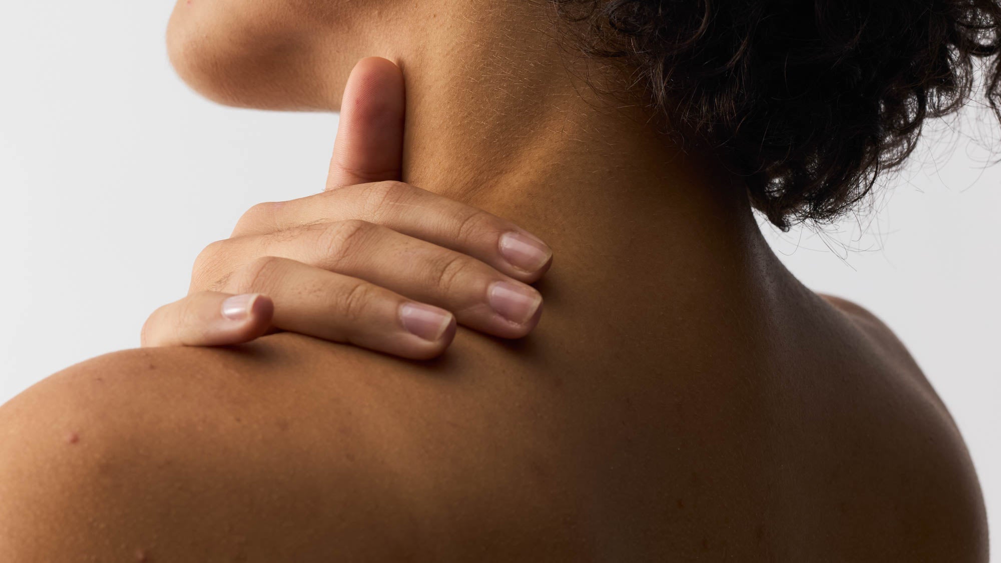 Pickel am Rücken sanft behandeln – natürliche Hilfe bei Bacne