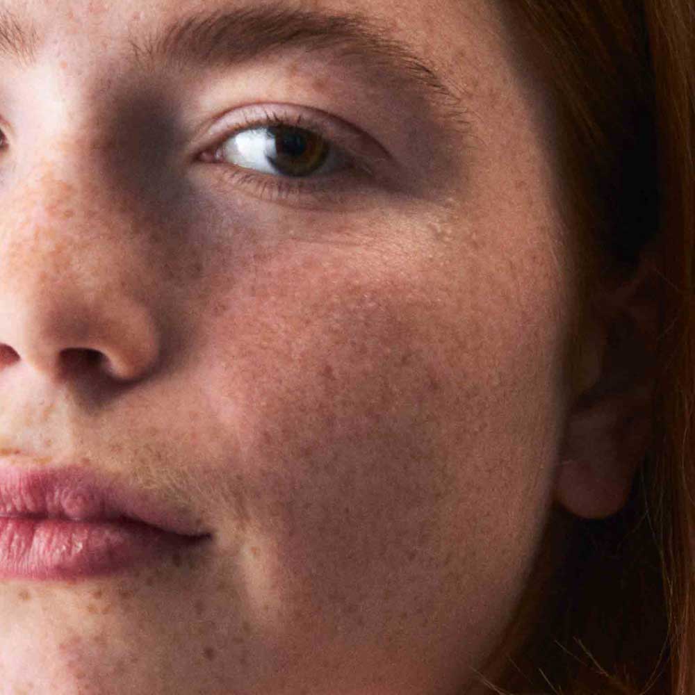 Gesicht Nahaufnahme von einer sensiblen Haut