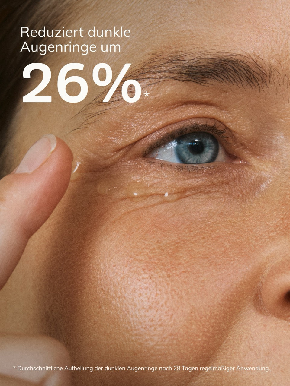 Werbung zur Augengel Studie von nkm mit Frauengesicht im Hintergrund