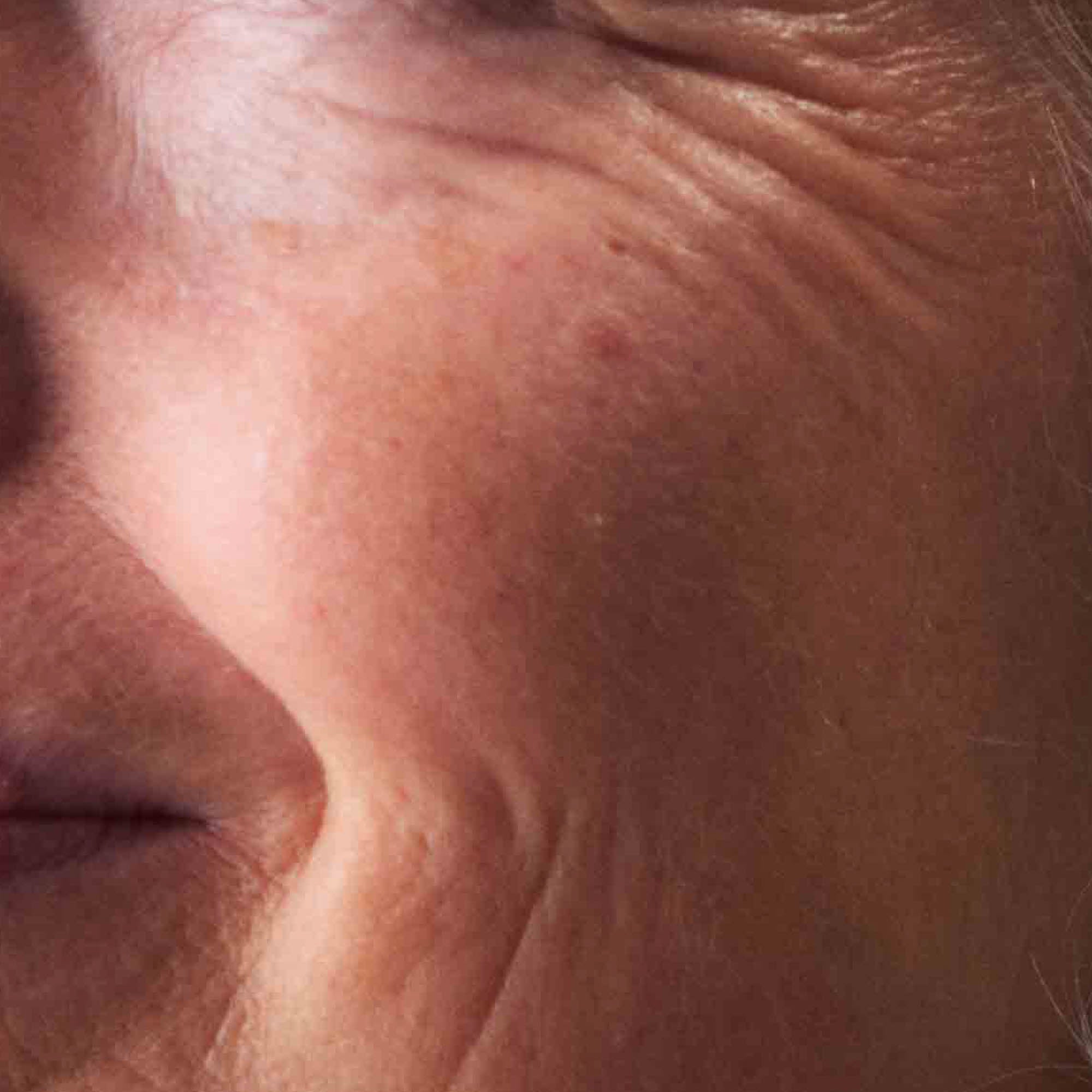 Nahaufnahme reife Haut