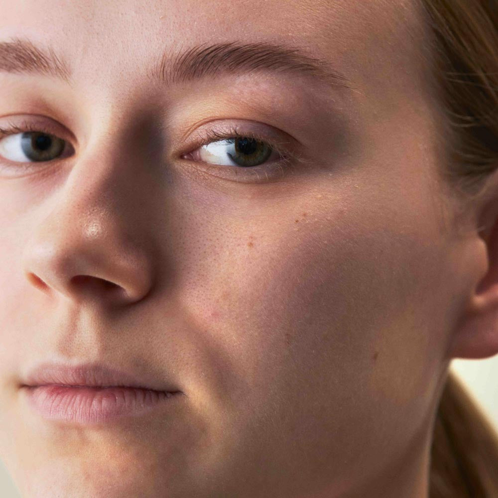 Gesicht Nahaufnahme von einer trockenen Haut
