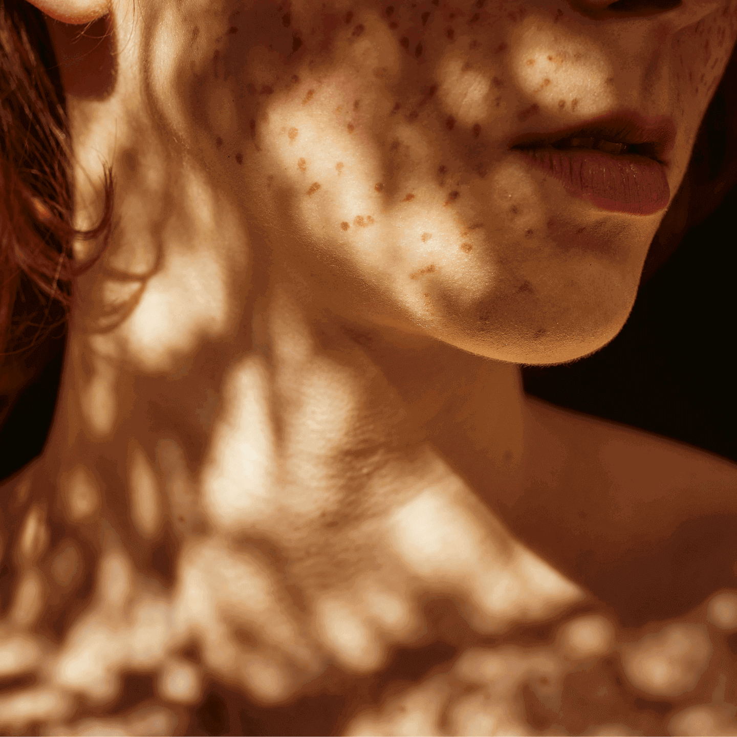 Hals einer Frau mit Sommersprossen