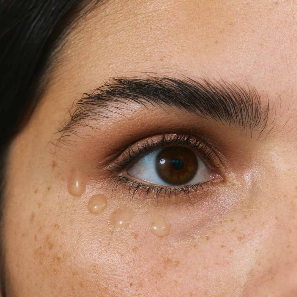 Auge mit aufgetragenem Abschwellendes Augengel