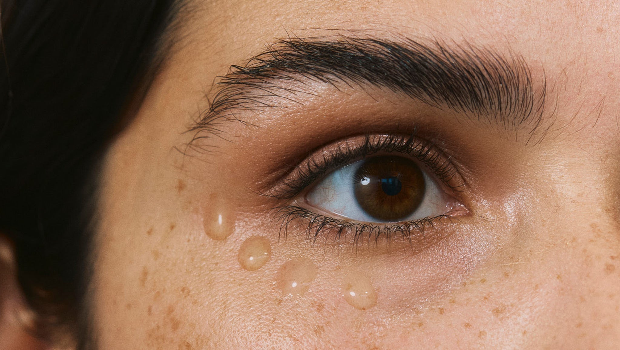 Dunkle Augenringe – Ursachen und Tipps