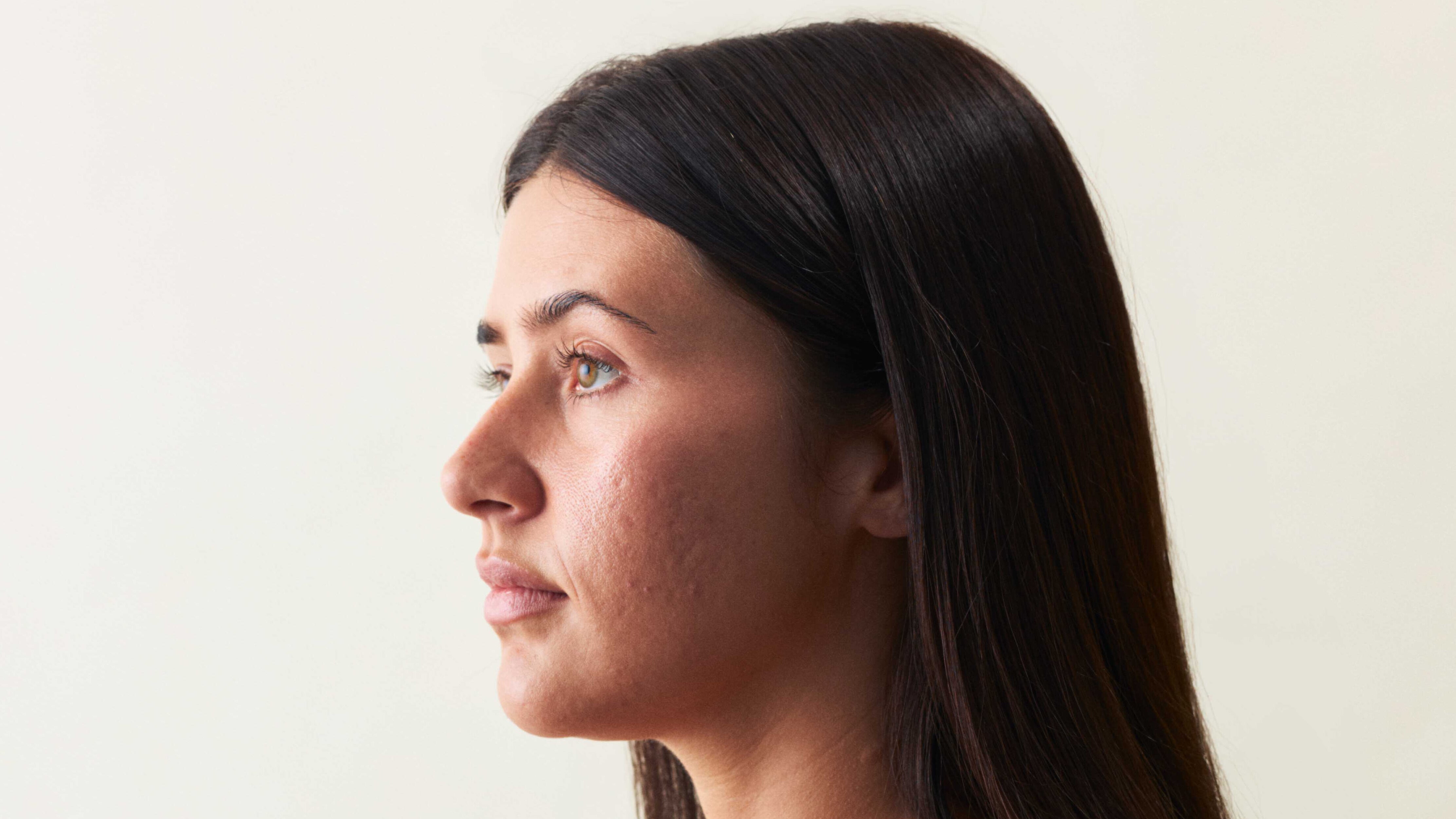 Wie entstehen Unreinheiten?