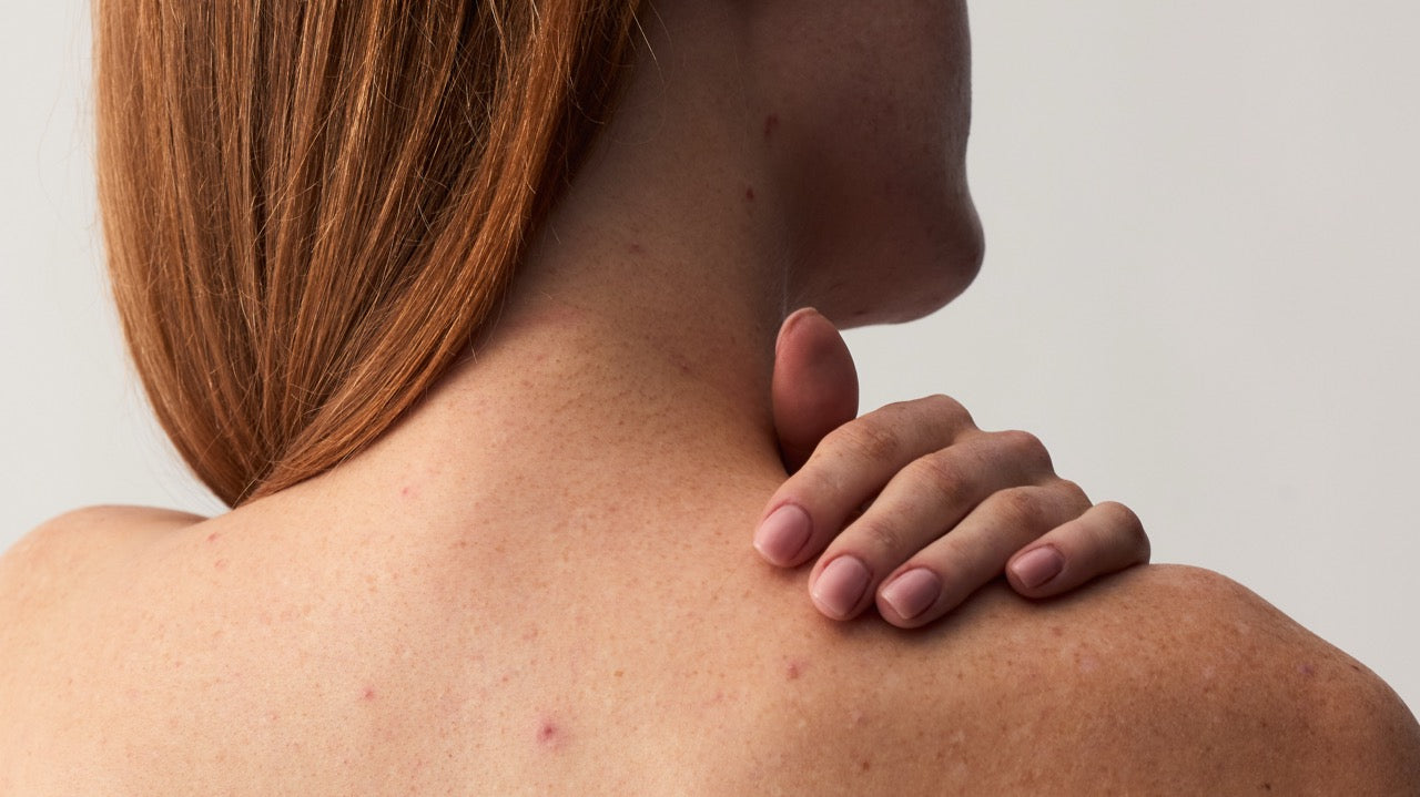 Hautkrankheiten - eine Hautärztin im Interview