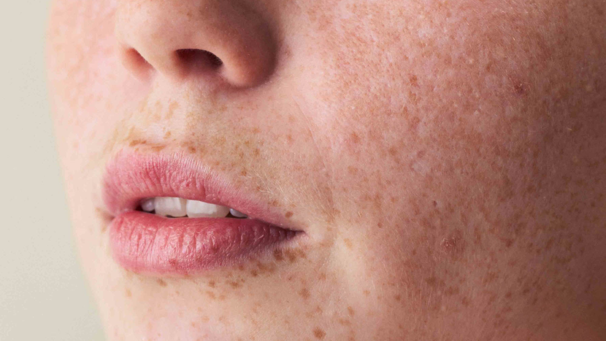 Lippenbalsam & Pflege: Was deine Lippen wirklich brauchen