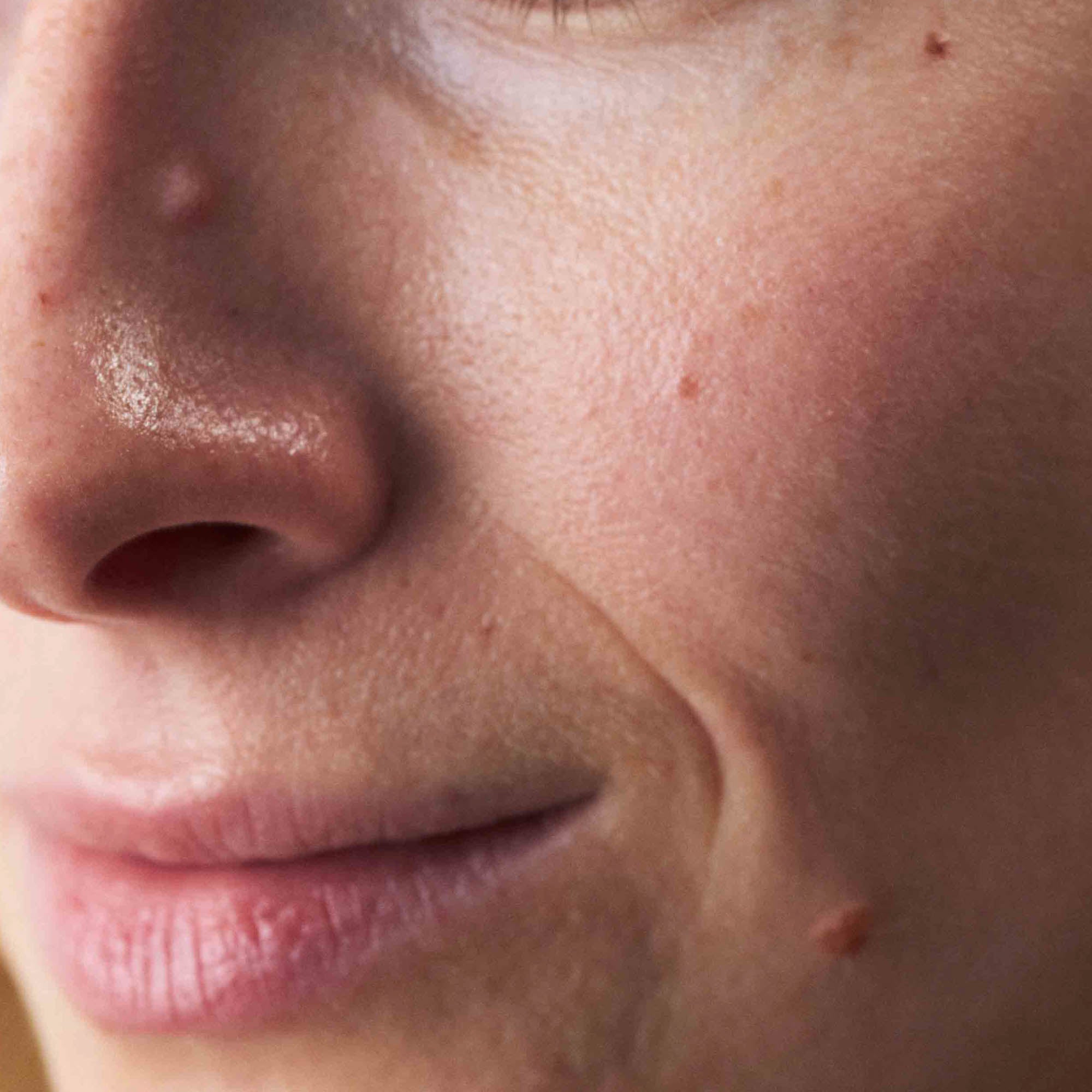 Nahaufnahme Mischhaut