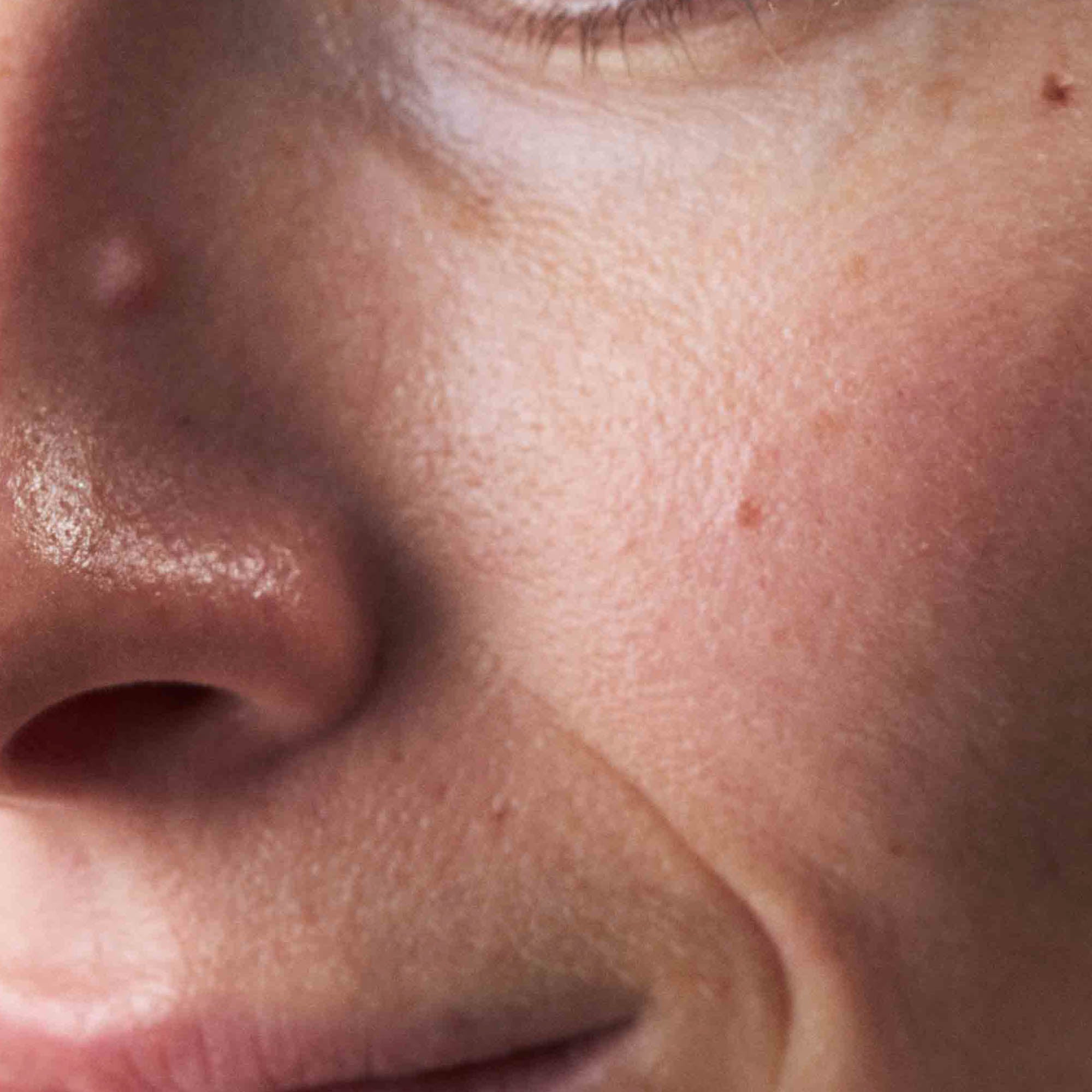 Nahaufnahme Mischhaut