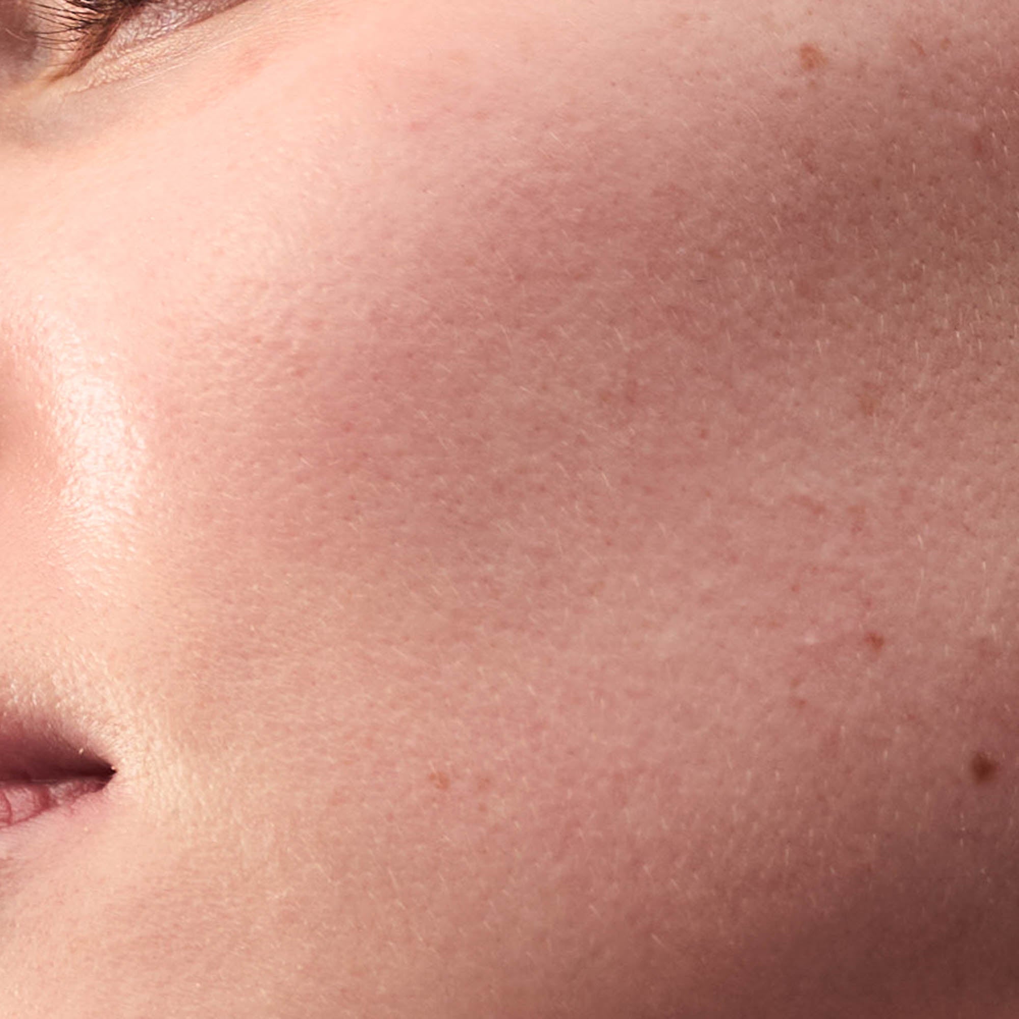 Nahaufnahme normale Haut