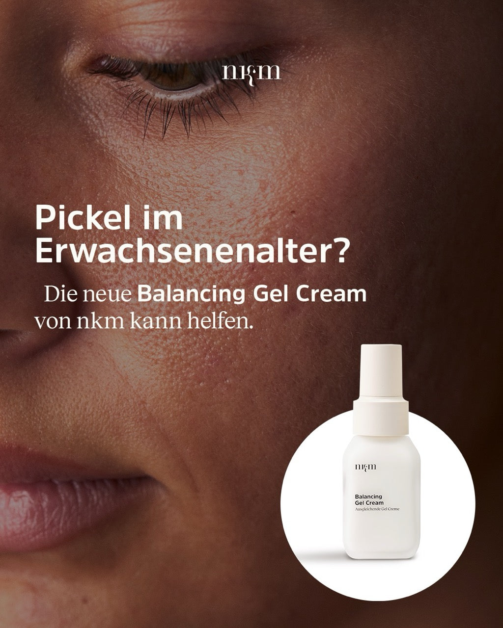 Werbung für die Balancing Gel Cream von nkm bei Unreinheiten im Erwachsenenalter