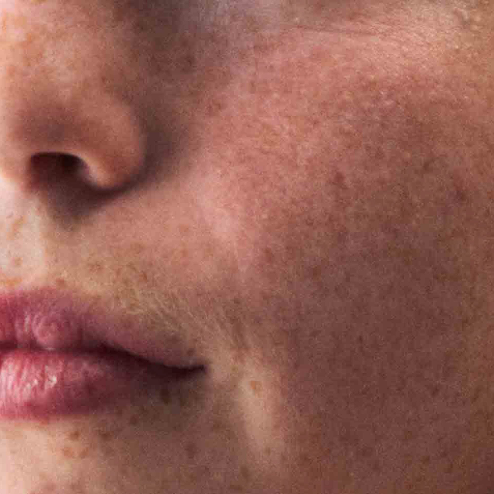 Nahaufnahme sensibler Haut